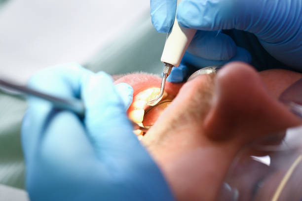 Best Emergency Dental Care for Broken or Chipped Teeth in Withamsville, OH