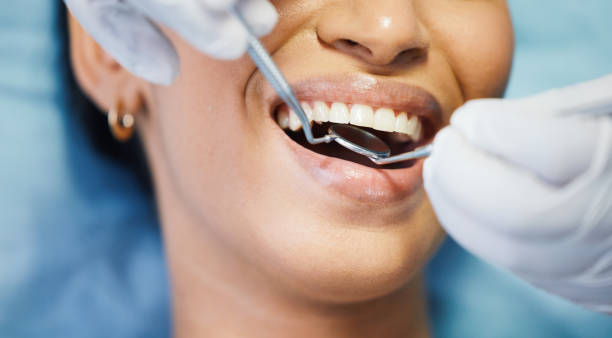 Best Emergency Gum Treatment in Withamsville, OH