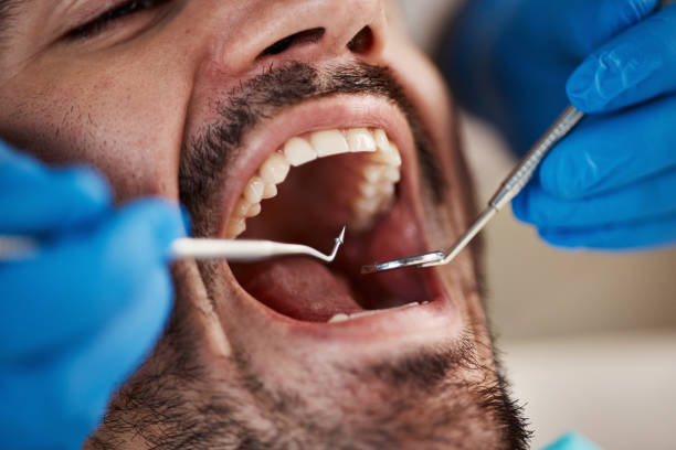 Best Emergency Denture Repair in Withamsville, OH