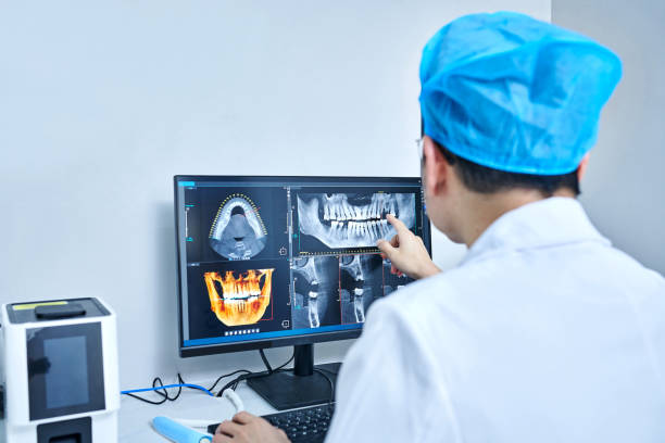 Best Emergency Wisdom Teeth Removal in Withamsville, OH