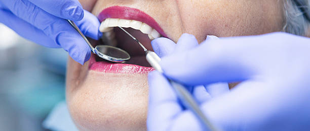 Best Emergency Treatment for Dental Infections or Abscesses in Withamsville, OH